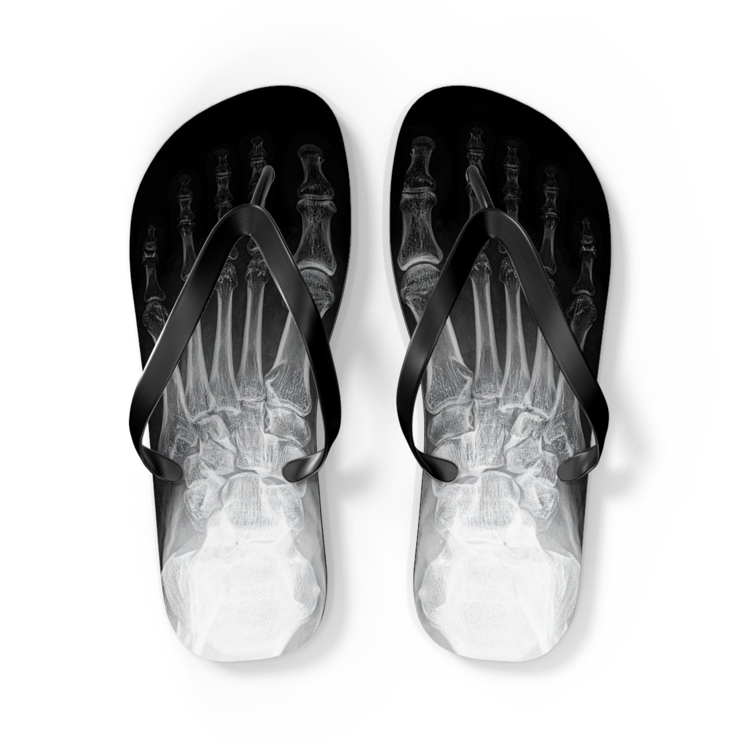 X-Ray Flip Flops