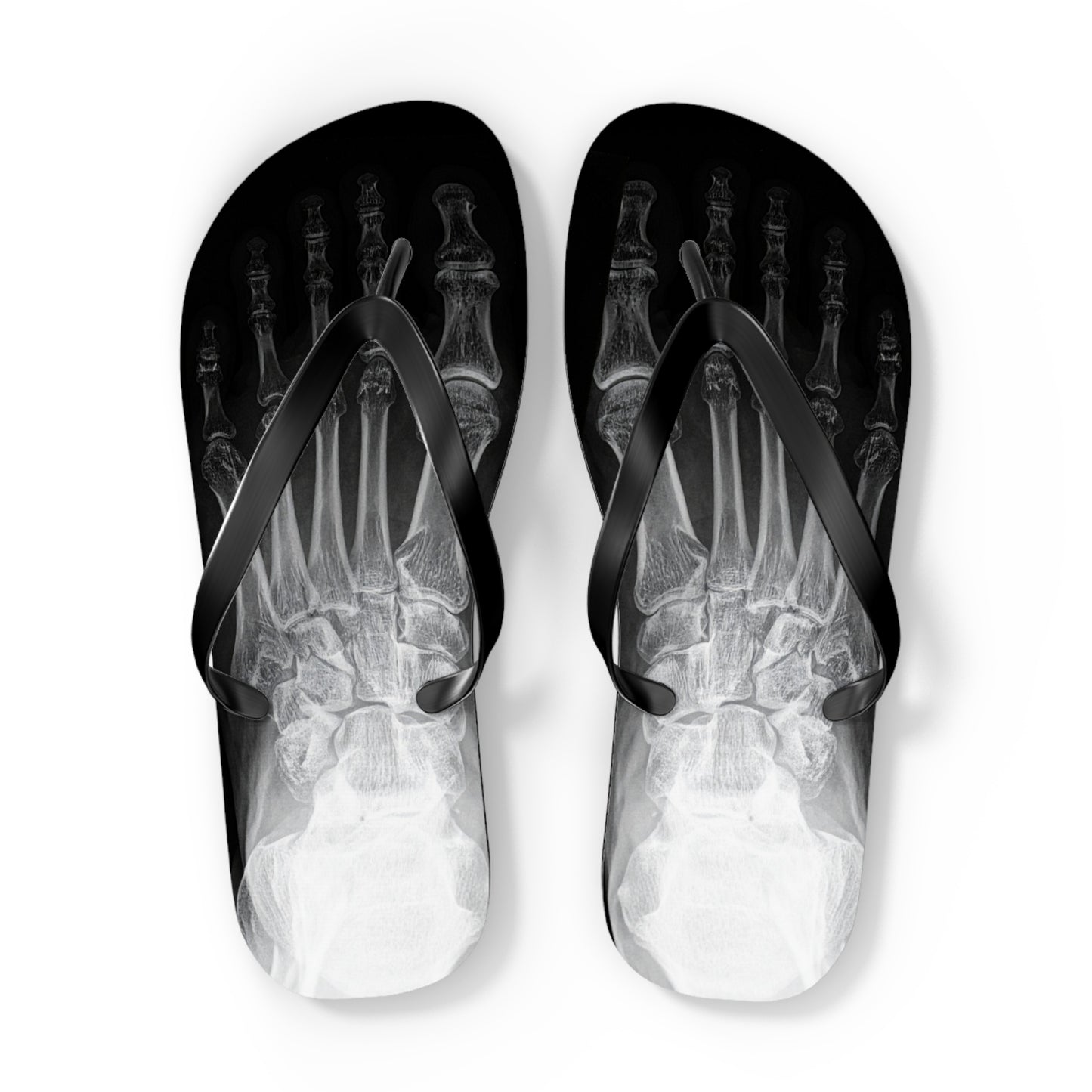 X-Ray Flip Flops