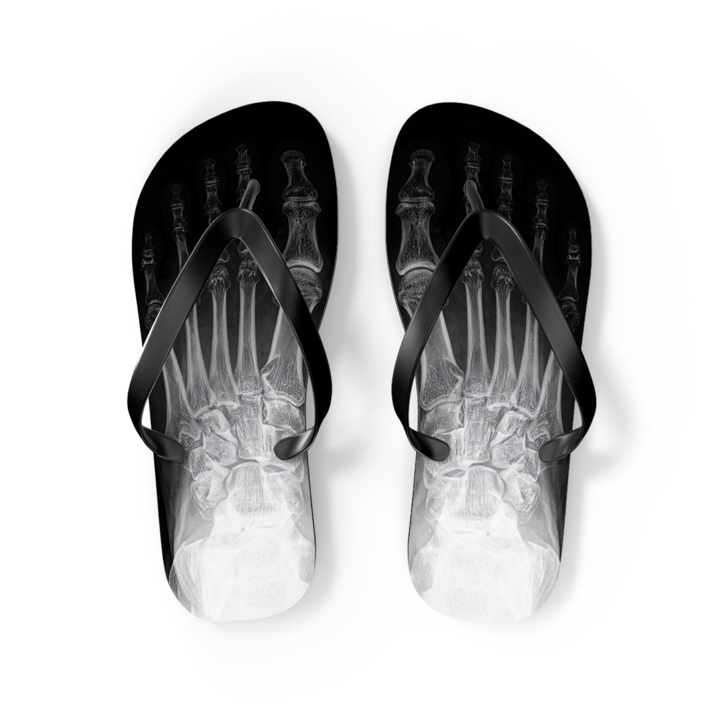 X-Ray Flip Flops
