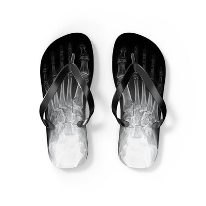 X-Ray Flip Flops