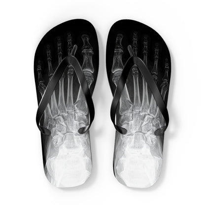X-Ray Flip Flops