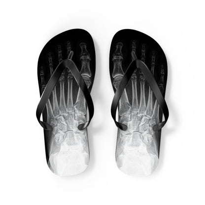 X-Ray Flip Flops