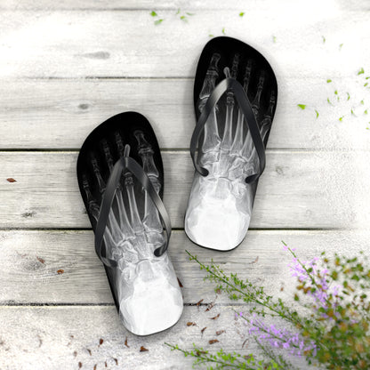 X-Ray Flip Flops